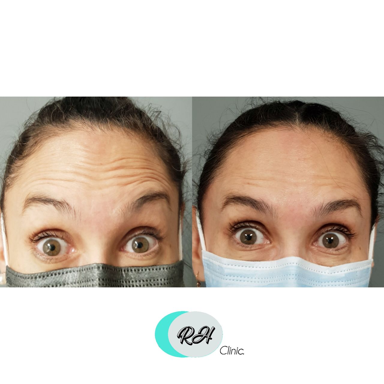 Rosalba Herrero Zerpa-74