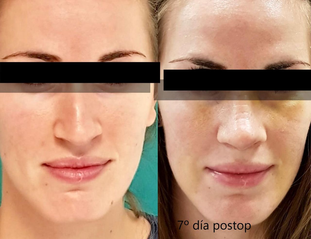 Enrique Bonanad Fernandez-9