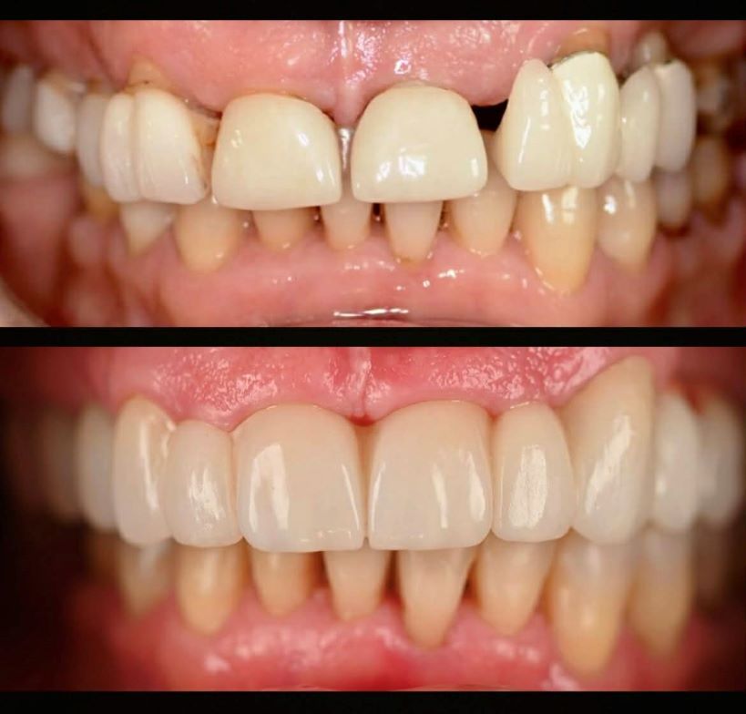 Magdalena Bińkowska-42