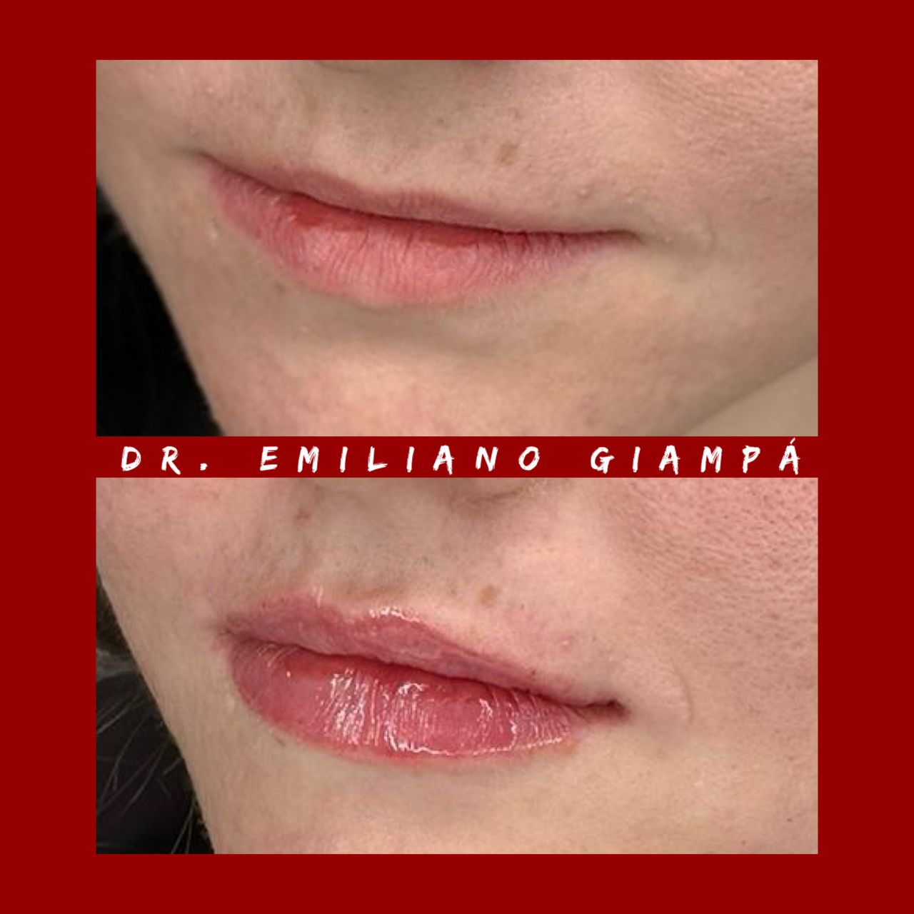 Emiliano Giampà-2