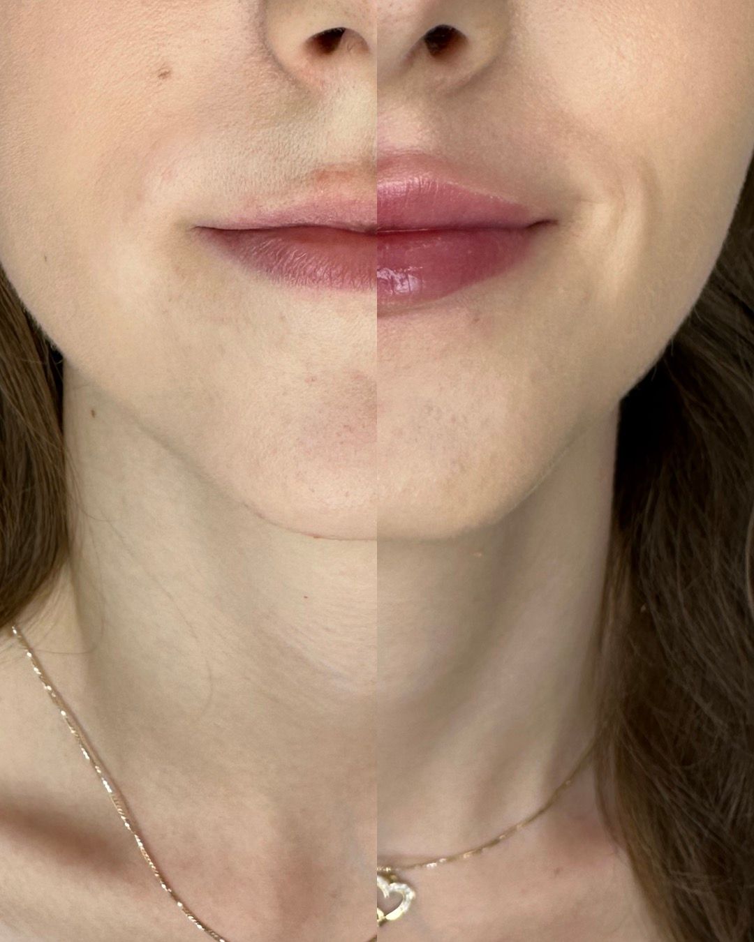 Michalina Zagańczyk-Bączek-28