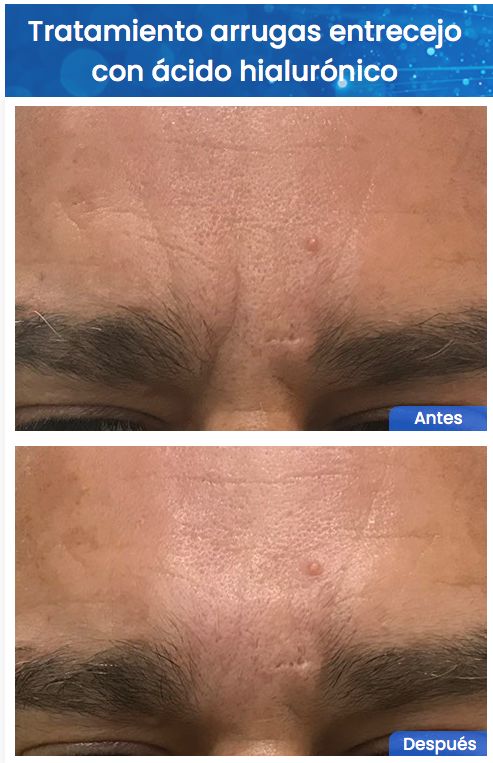 Juan Enrique Pérez Enríquez-138