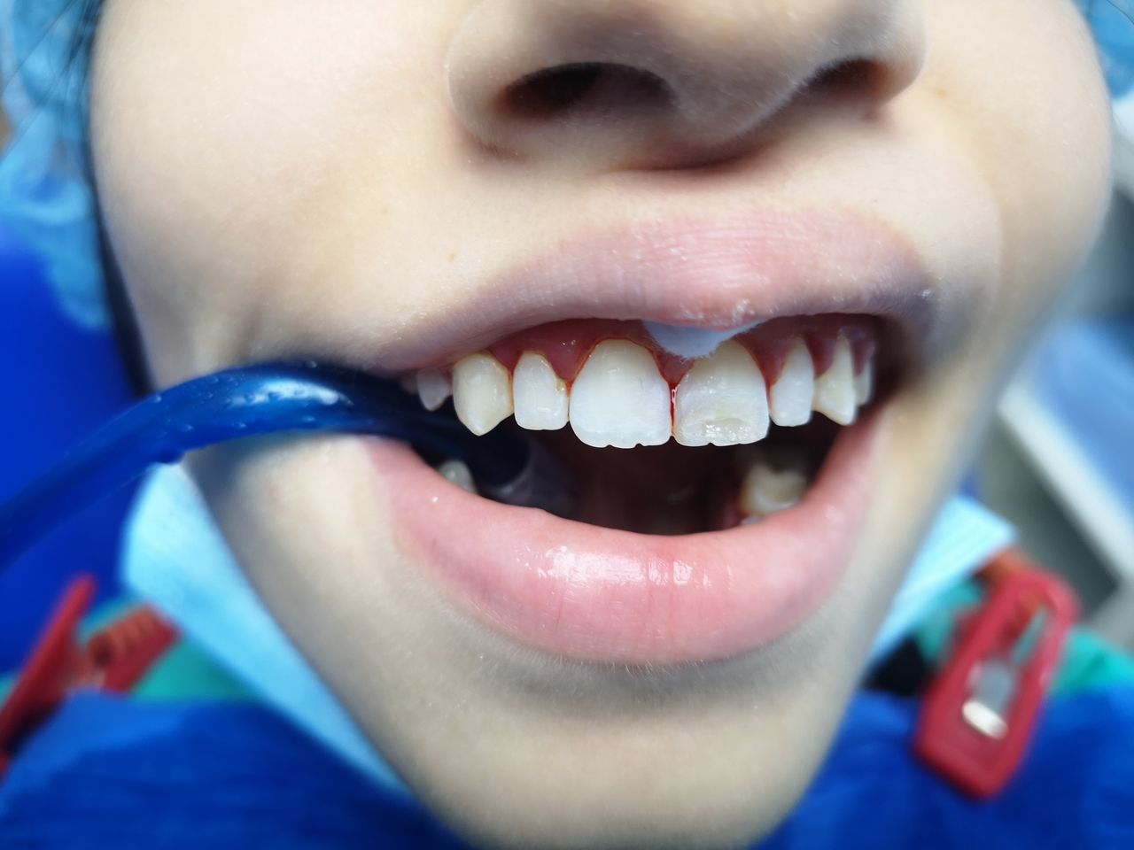 Stefano De Simone-101