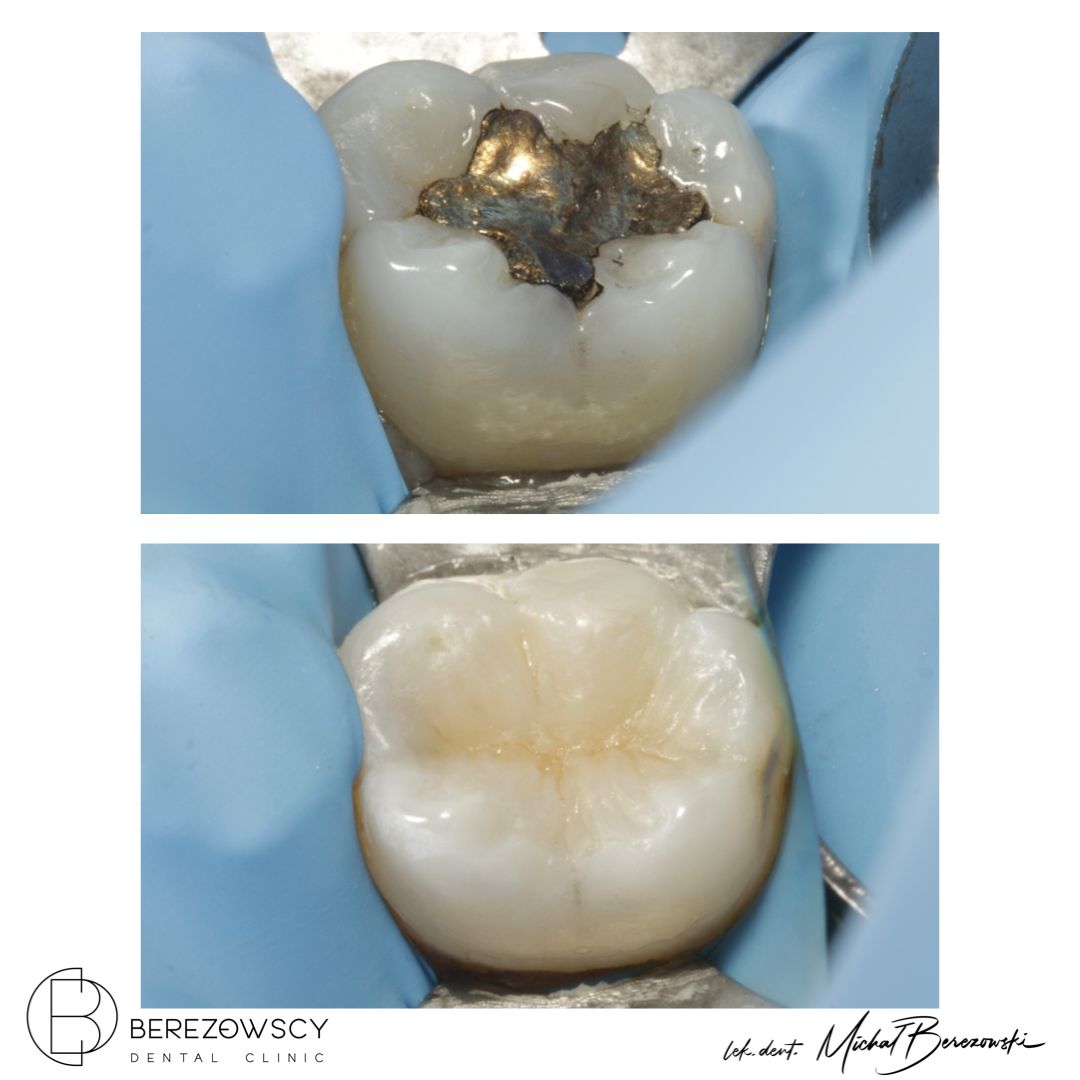 Michał Berezowski-27