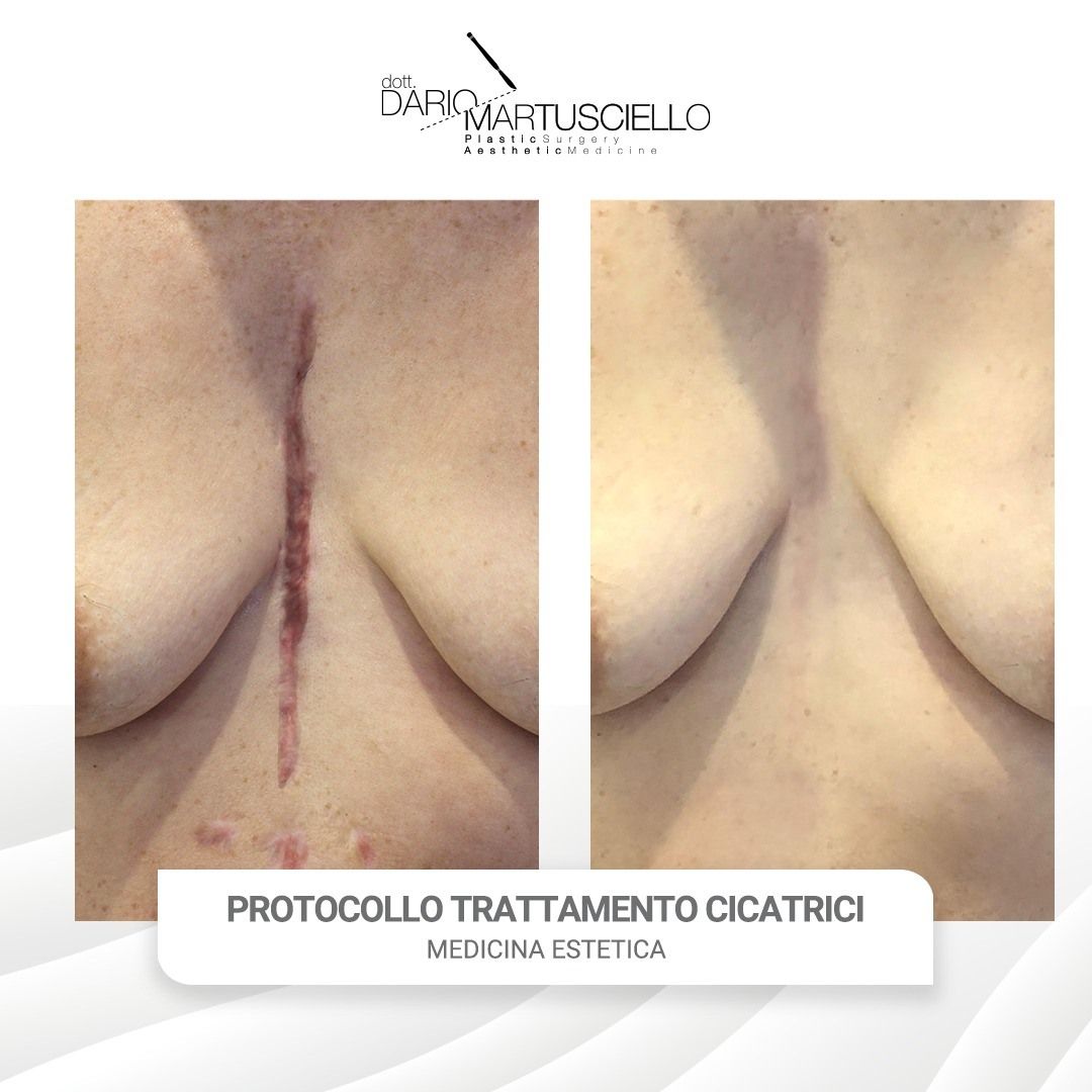 Dario Martusciello-15