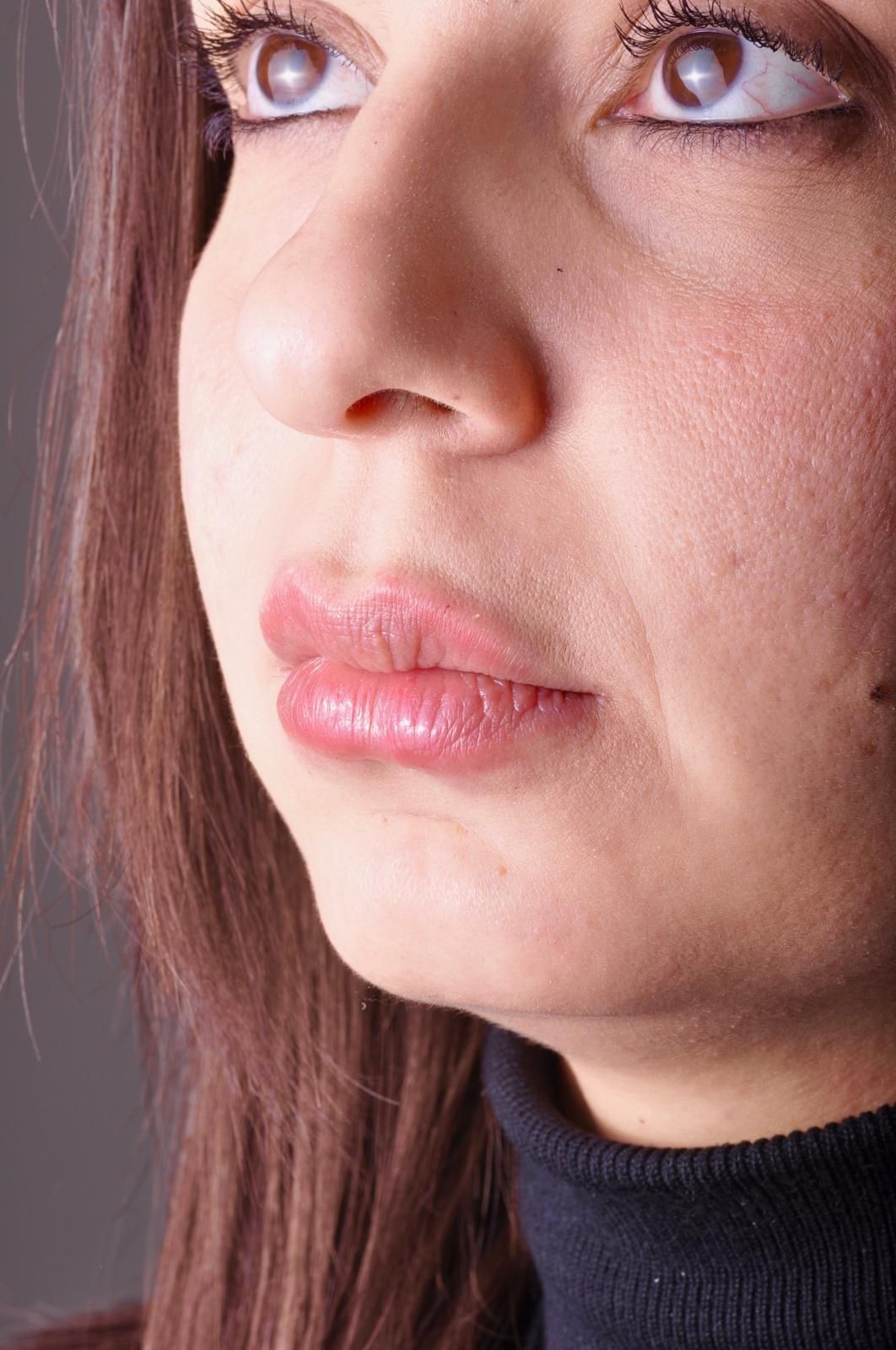 Alberto Alessandri-1