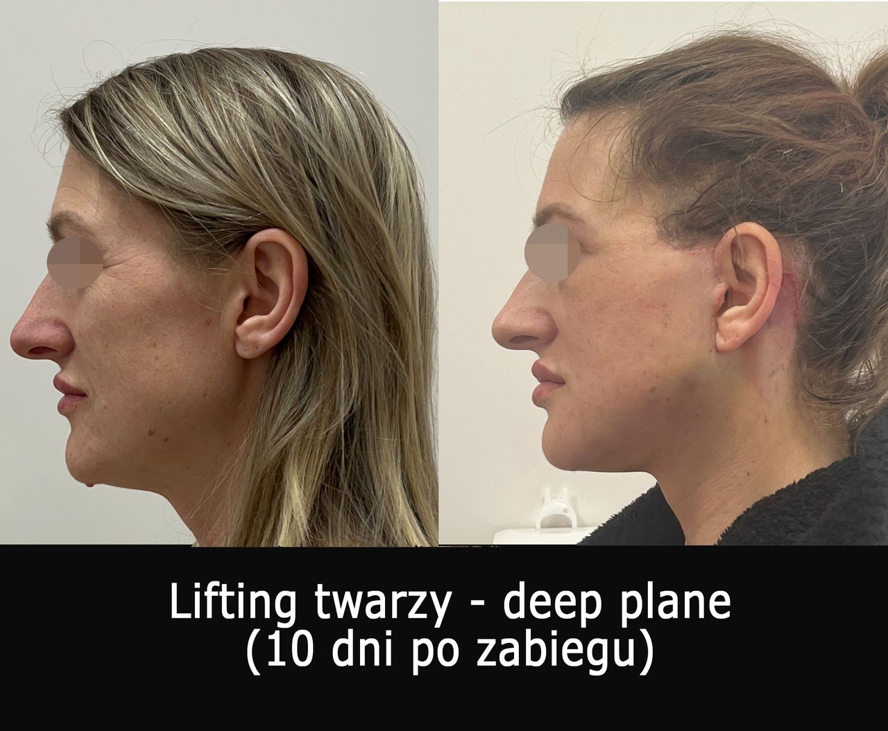 Mariusz Zagajewski-8