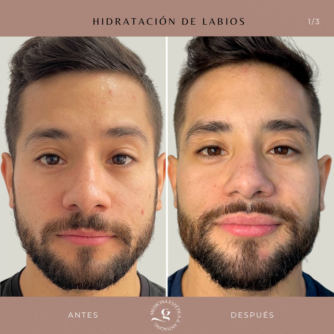 ​Giovanni Giorgianni-9