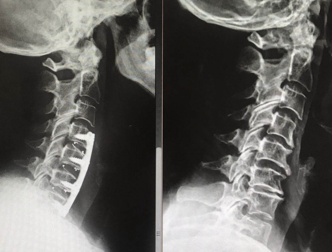 Juan Camilo Hernandez Acevedo-23