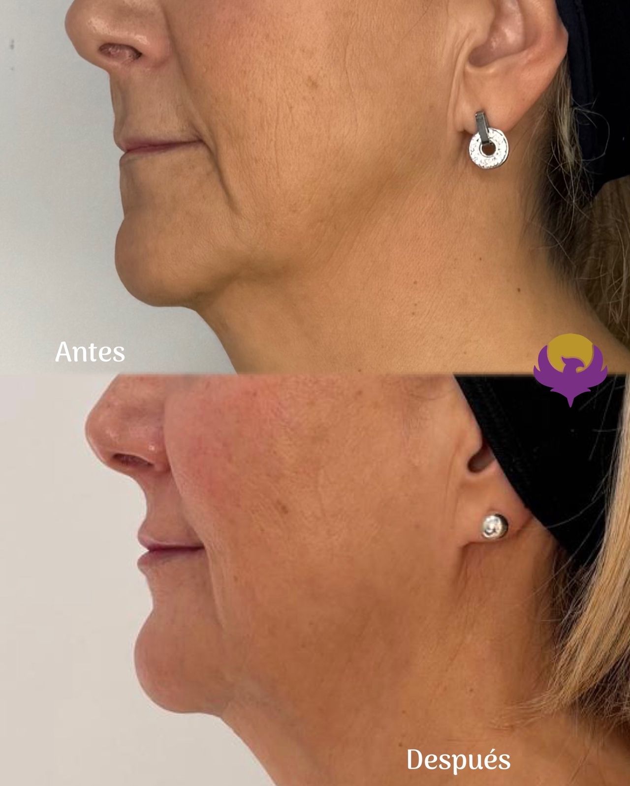 Yessica Corrales Acevedo-8