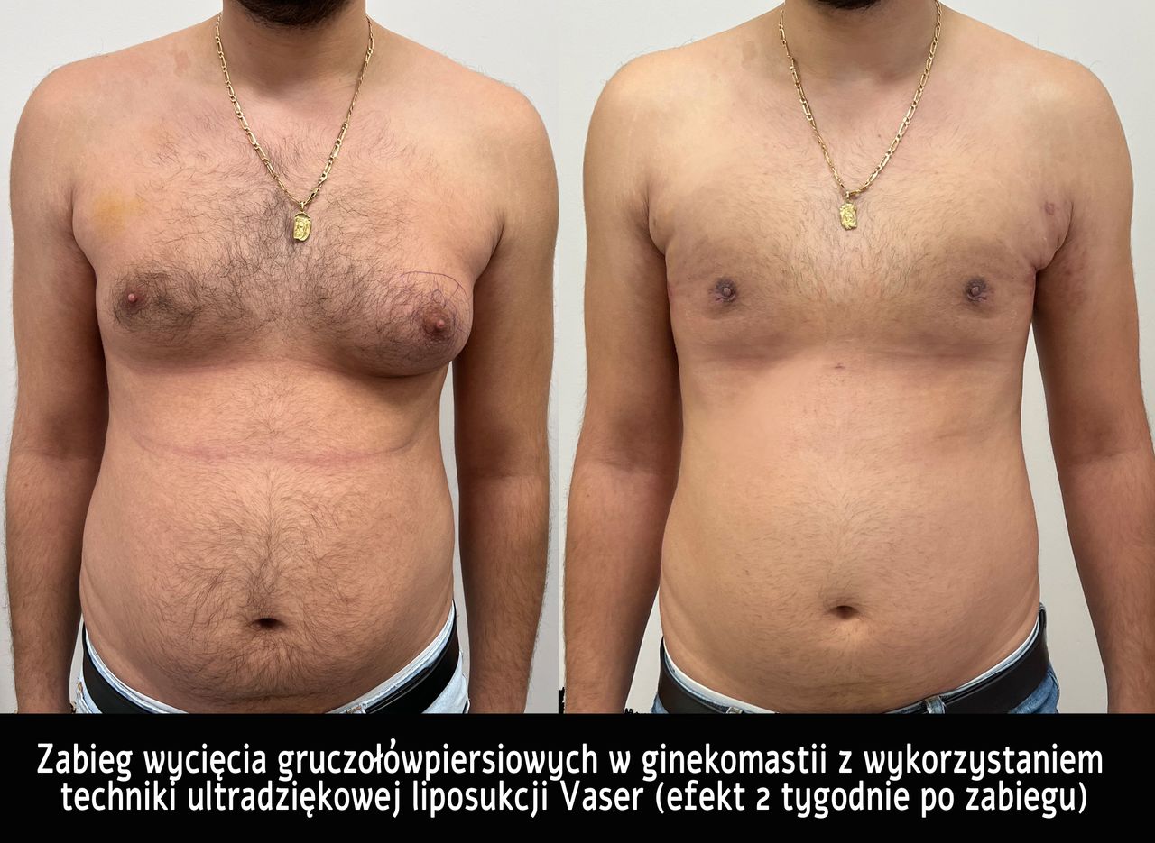 Mariusz Zagajewski-33