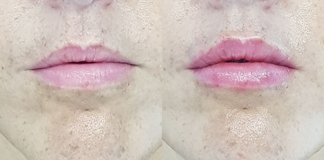 Rosalba Herrero Zerpa-163