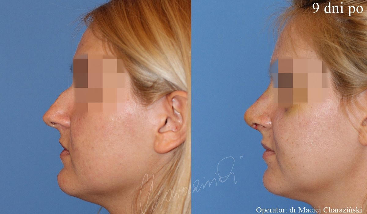 Maciej Charaziński-20