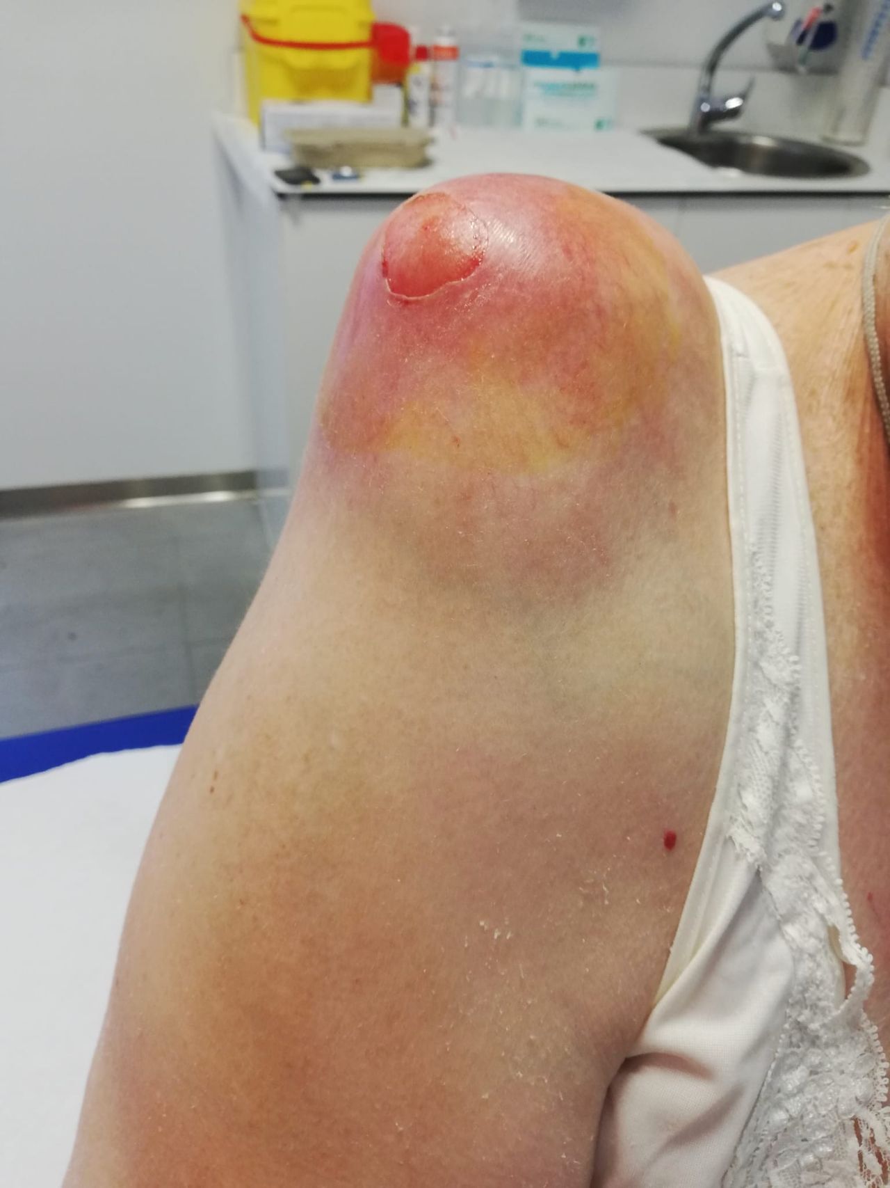 Eulogio Benito Martín-23