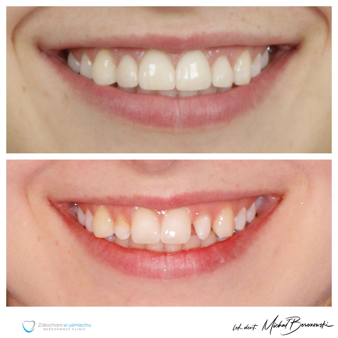 Michał Berezowski-25