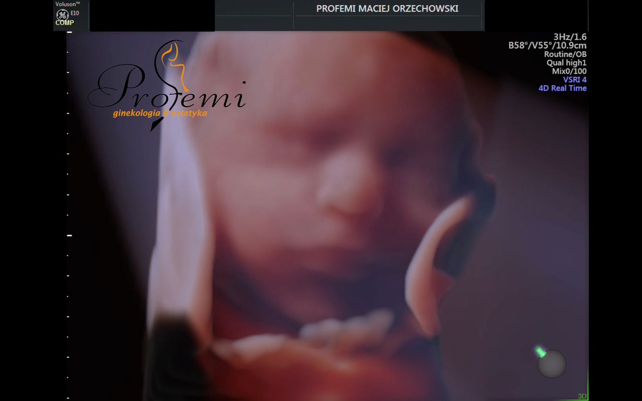 Maciej Orzechowski-23