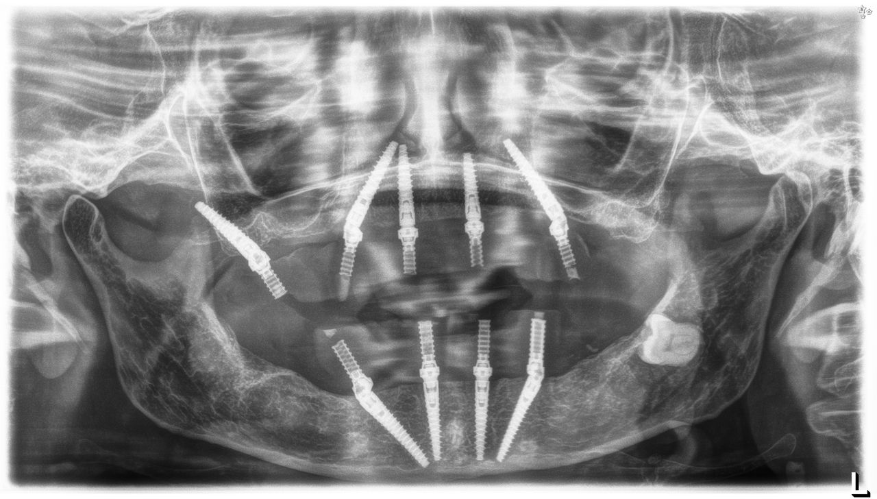 Lorenzo Polpatelli-1