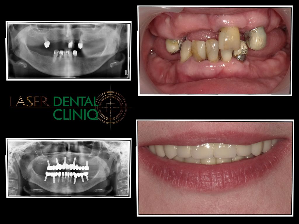 Magdalena Przybysz-23