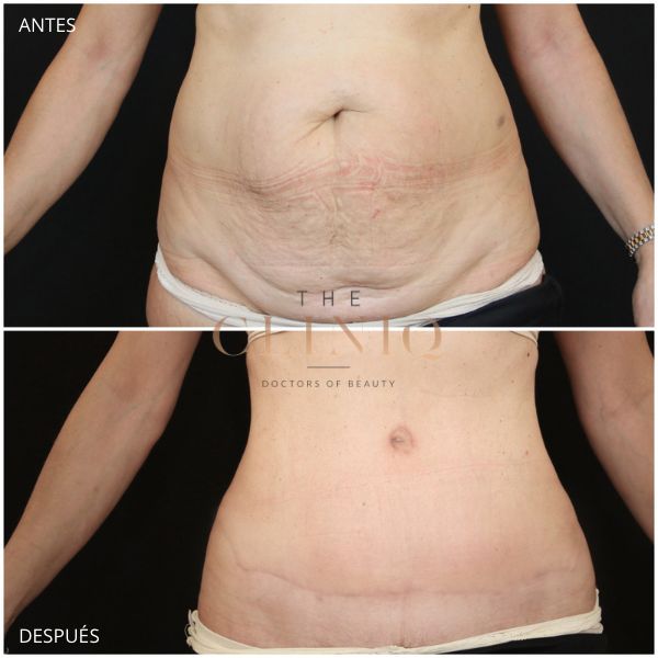 Ricardo Coronel Gagliardi-3