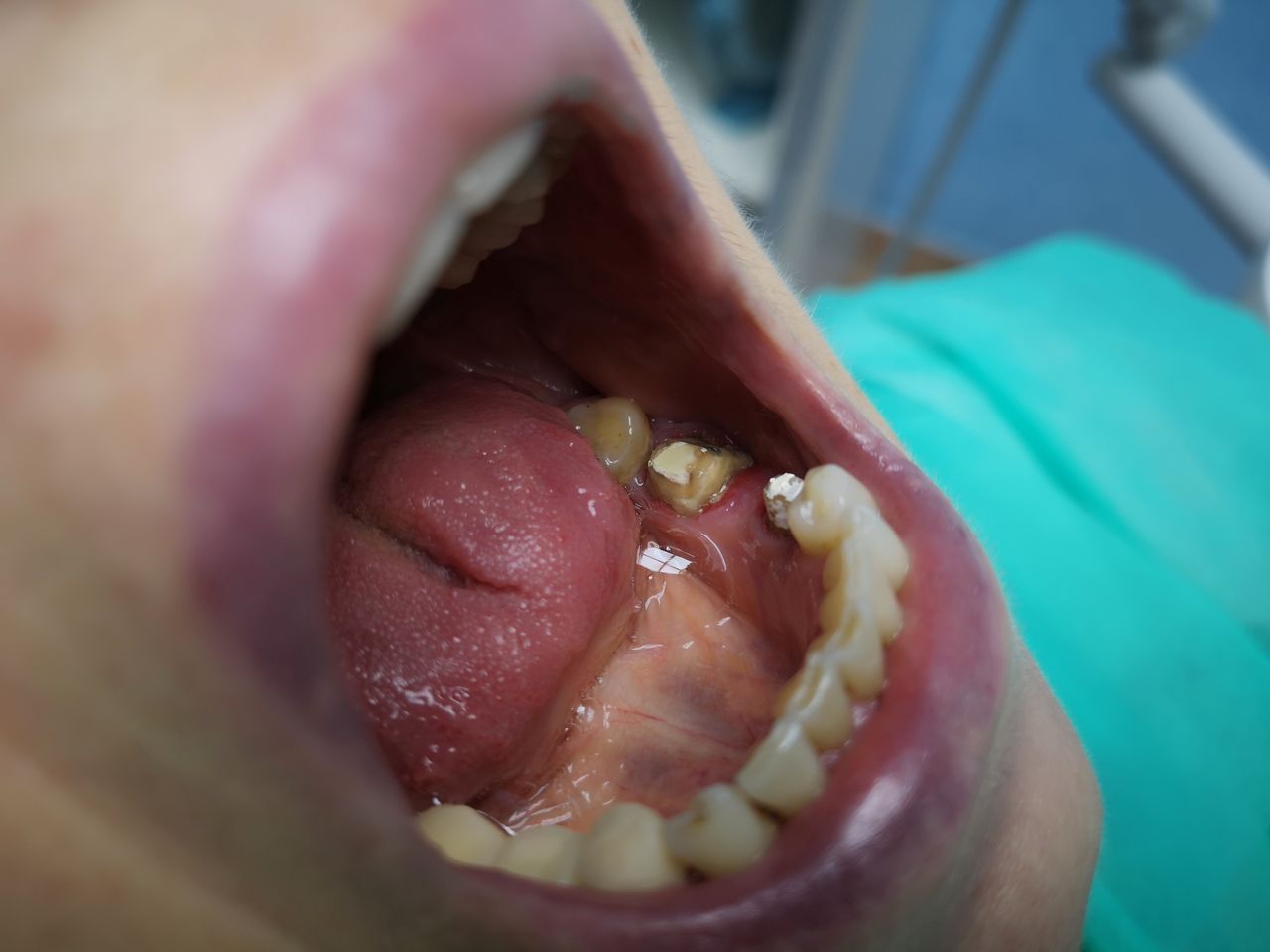 Stefano De Simone-82