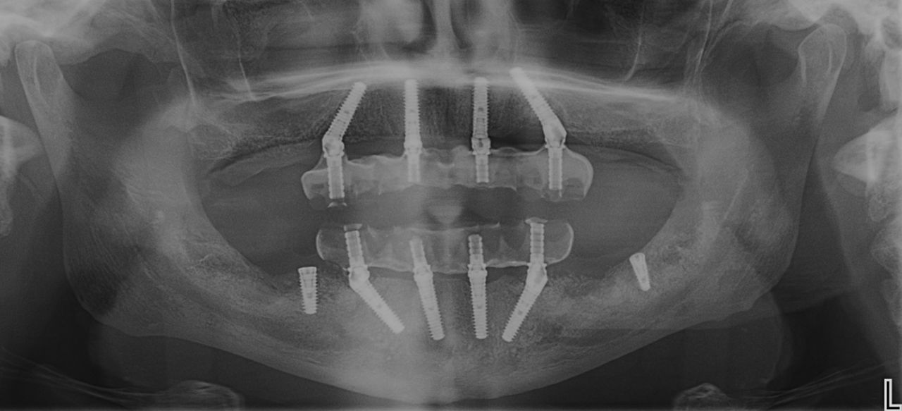 Raffaele D'ambrosio-3