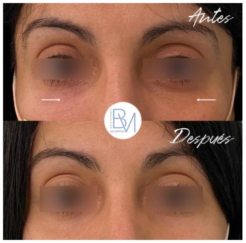 Beatriz Moralejo-138