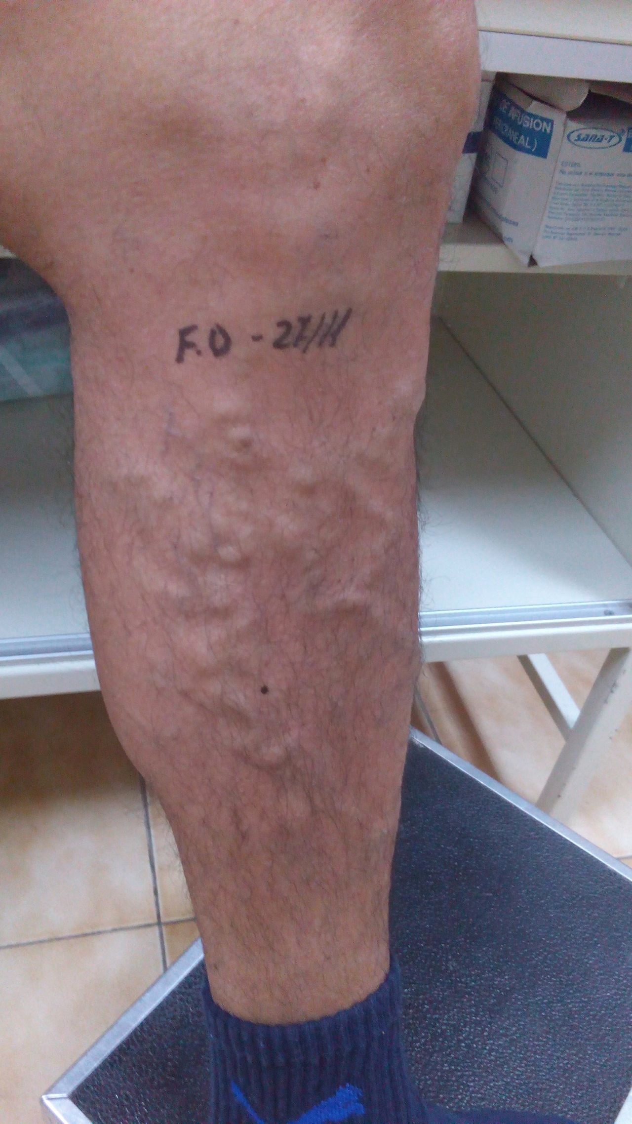 Arnaldo Strazzaboschi-6