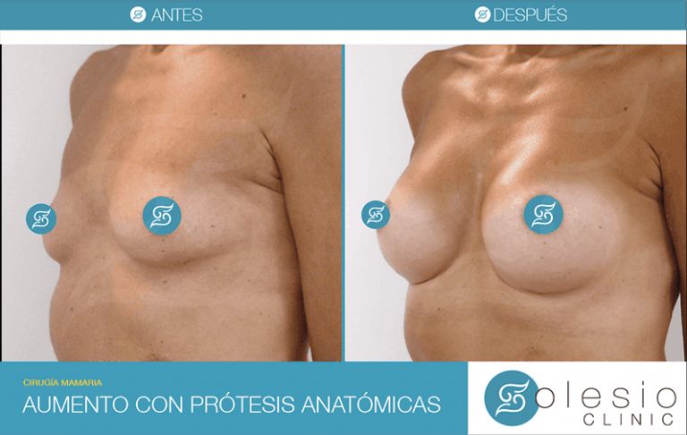 Francisco Solesio Pilarte-6