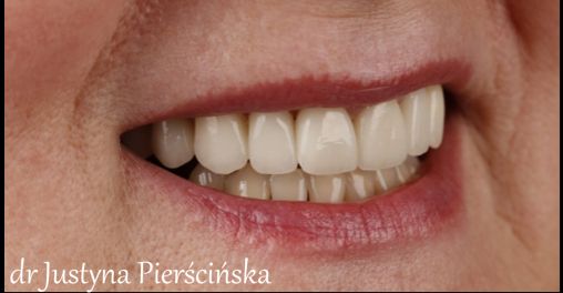 Justyna Pierścińska-5
