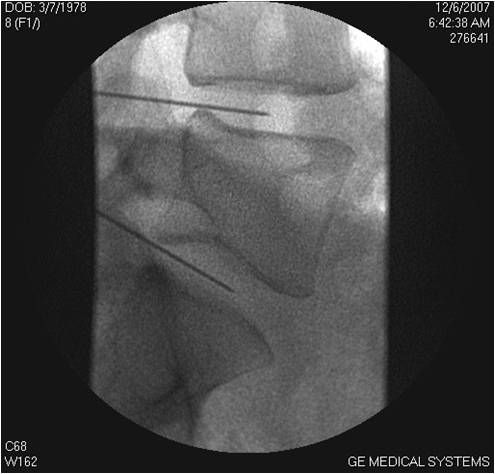 Carmine Del Gaìzo-13