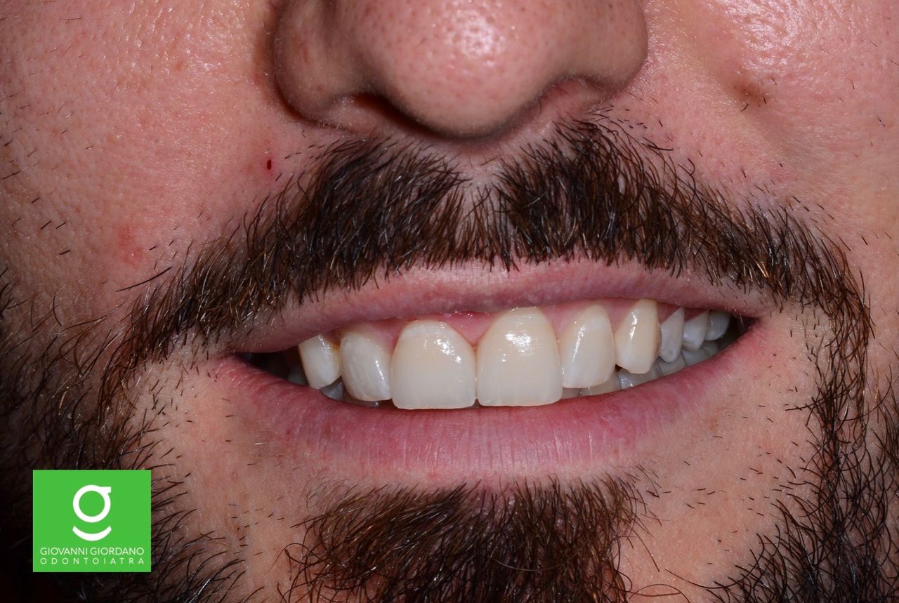 Giovanni Giordano-10