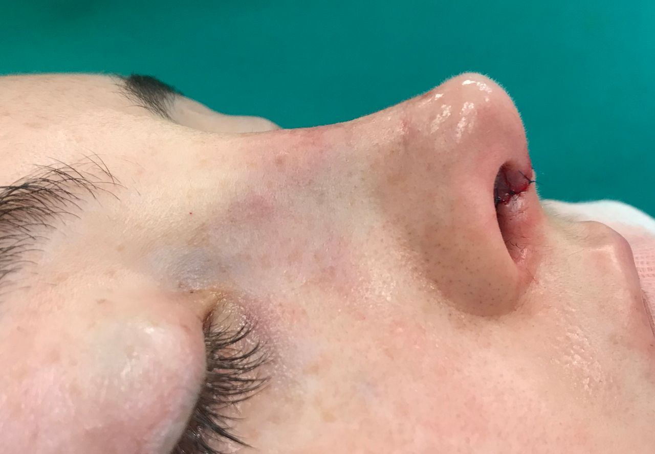 Alvaro Perez Villar-12