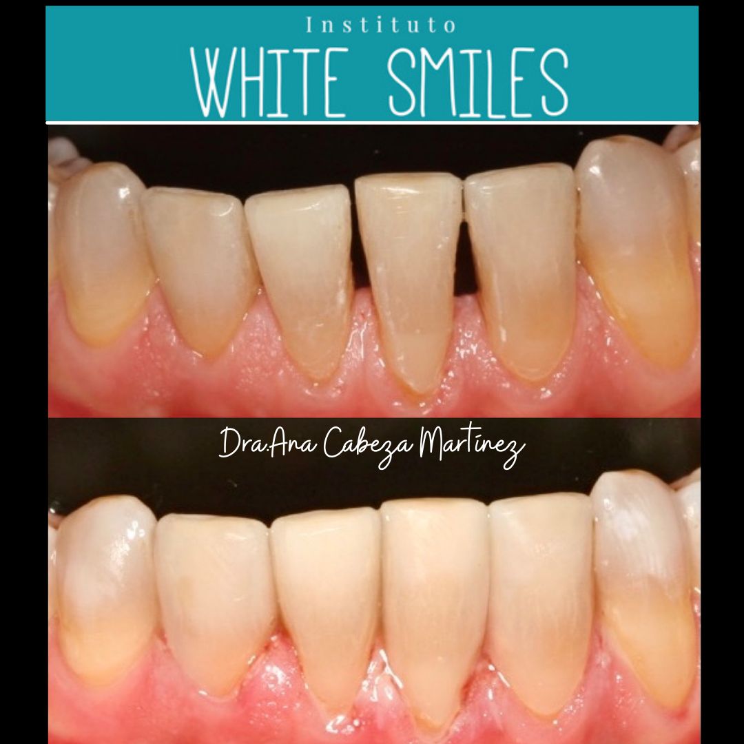 Ana Cabeza Martinez-21