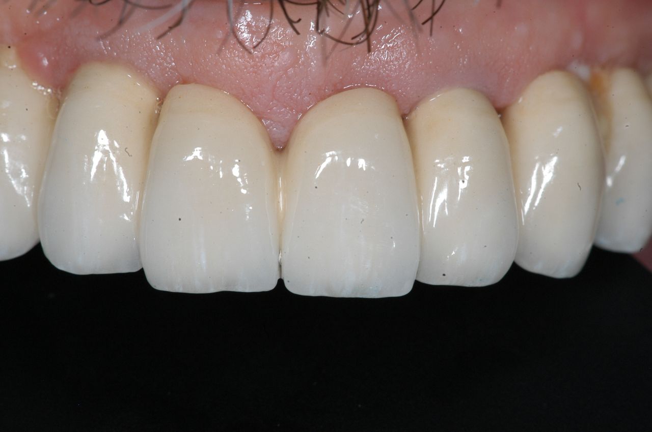 Alessandro Palumbo-26