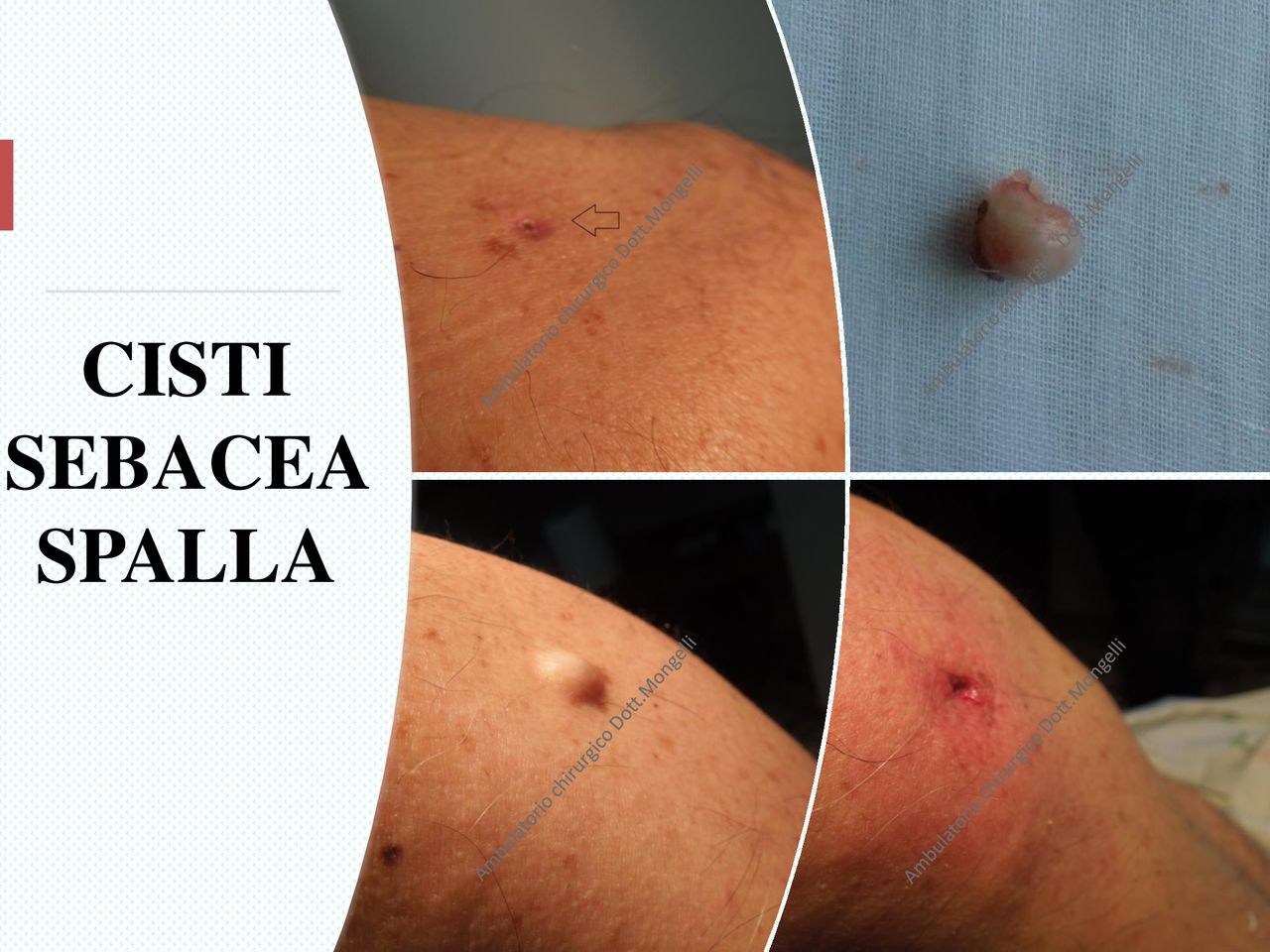 Matteo Antonio Mongelli-25