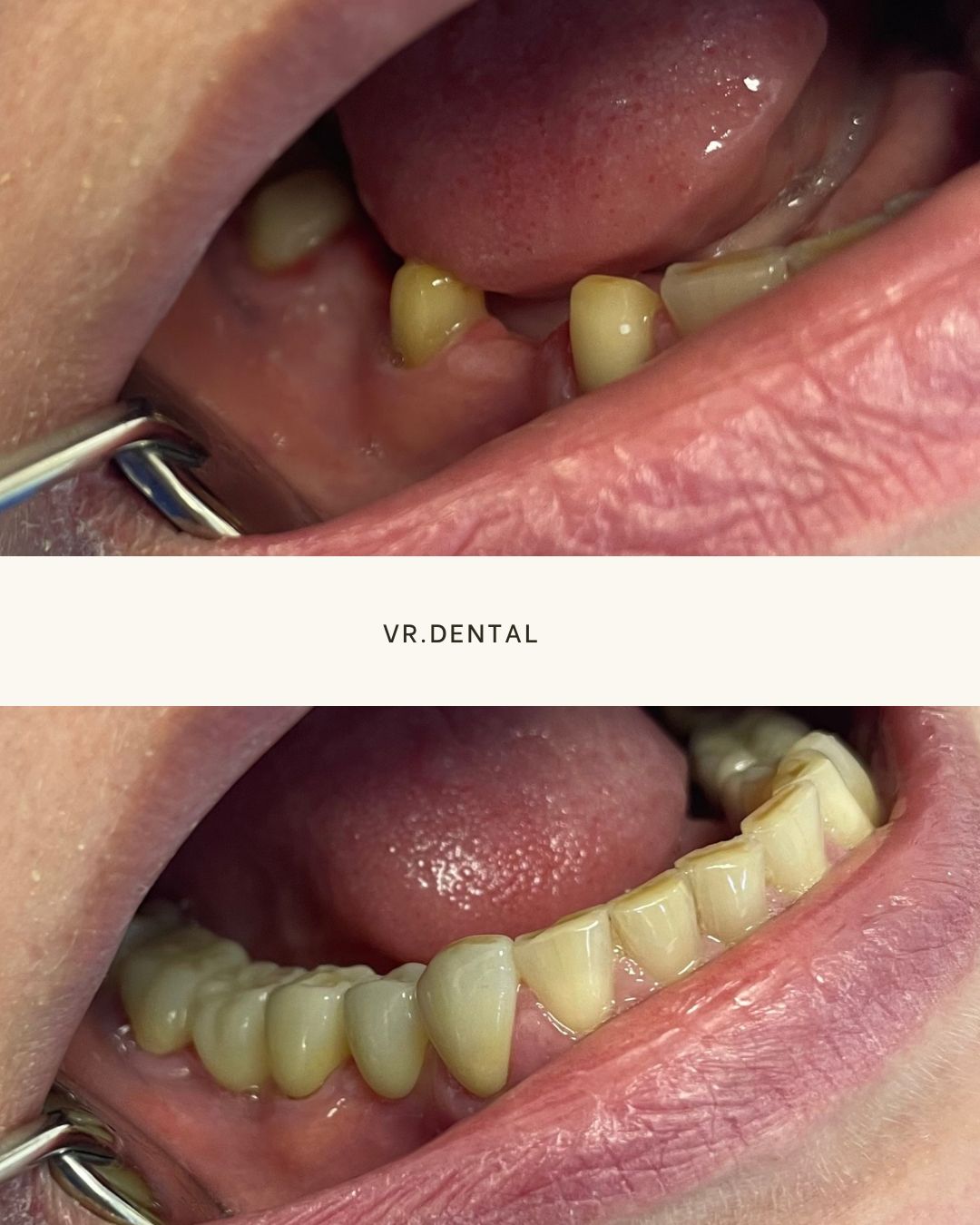 Viktor Rohozhynskiy-2