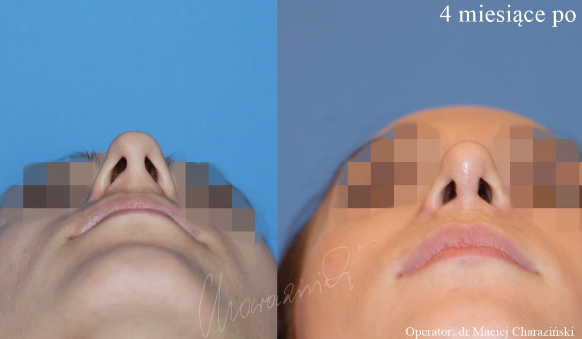 Maciej Charaziński-72