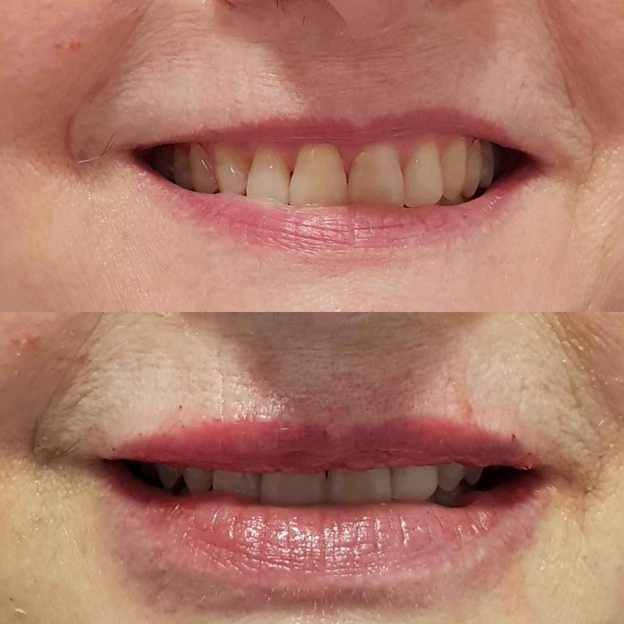 Rosalba Herrero Zerpa-313