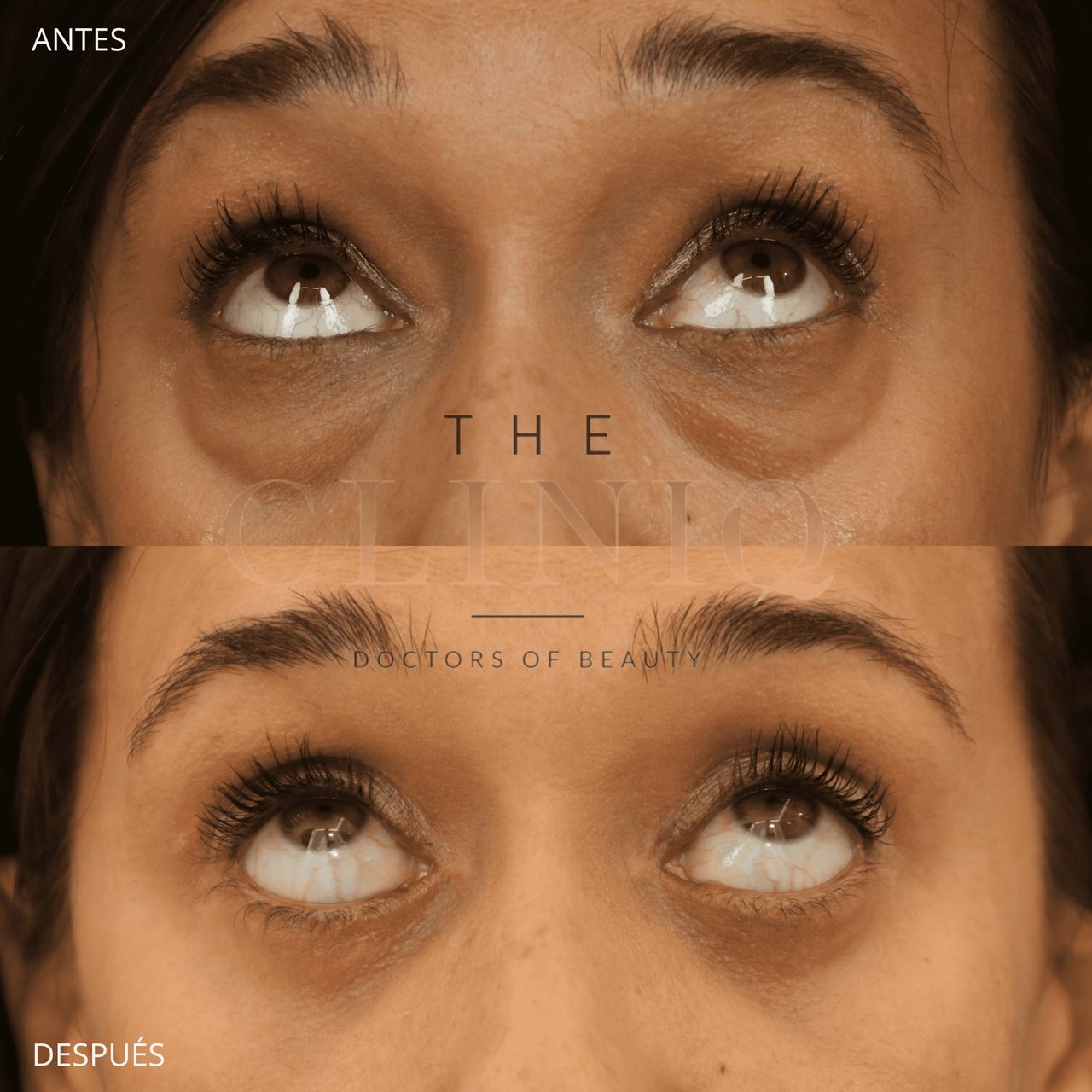 Ignacio Genol Saavedra-13