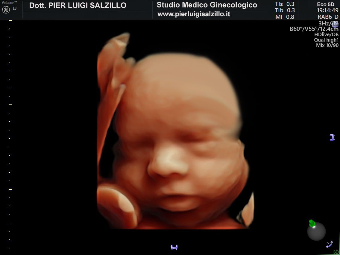 Pier Luigi Salzillo-2