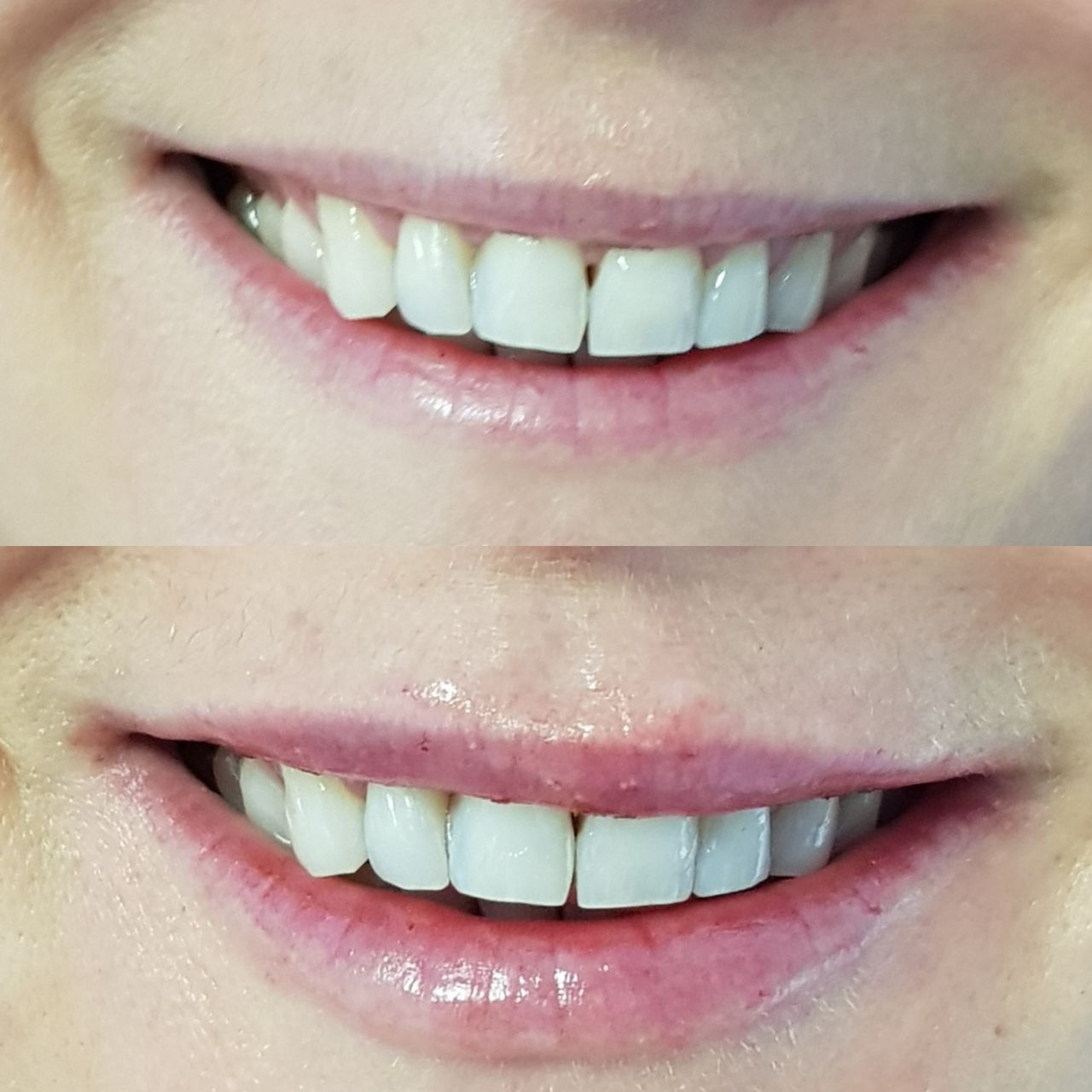 Rosalba Herrero Zerpa-194