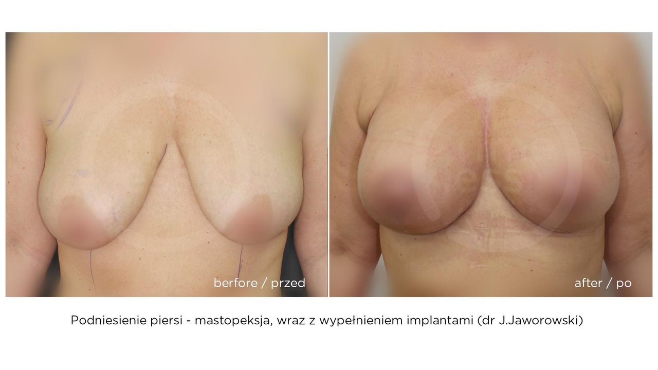 Janusz Jaworowski-49