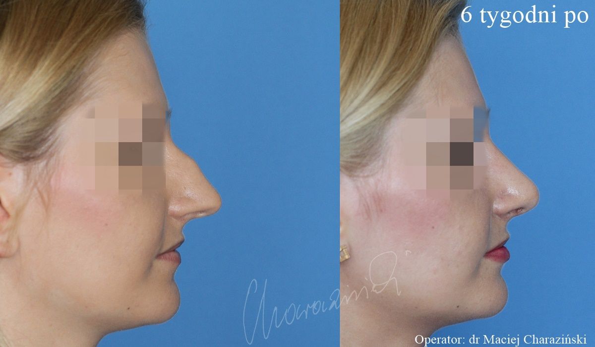 Maciej Charaziński-71