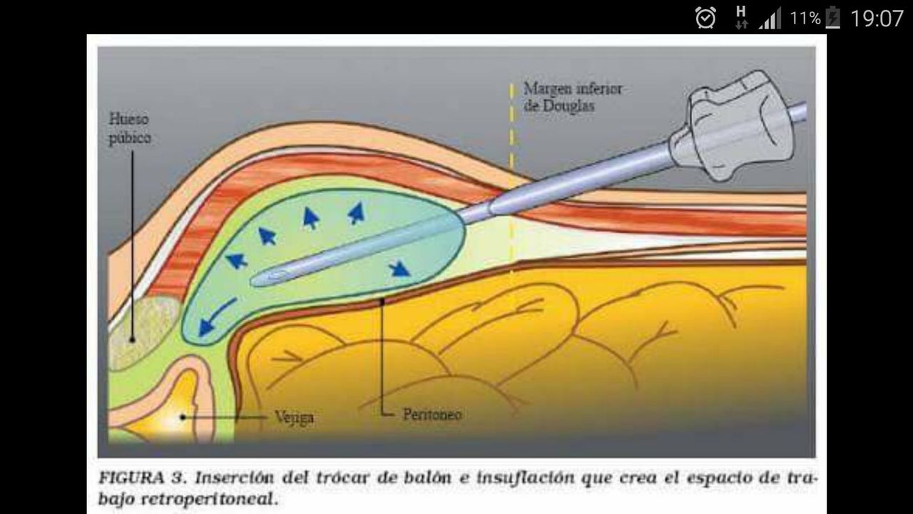 Luis Fernando Susaníbar Napurí-46