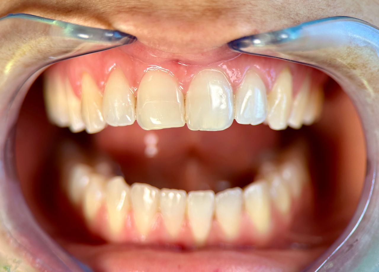 Alberto Bortoletti-2