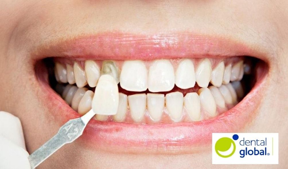 Rebeca Perez Garcia-6