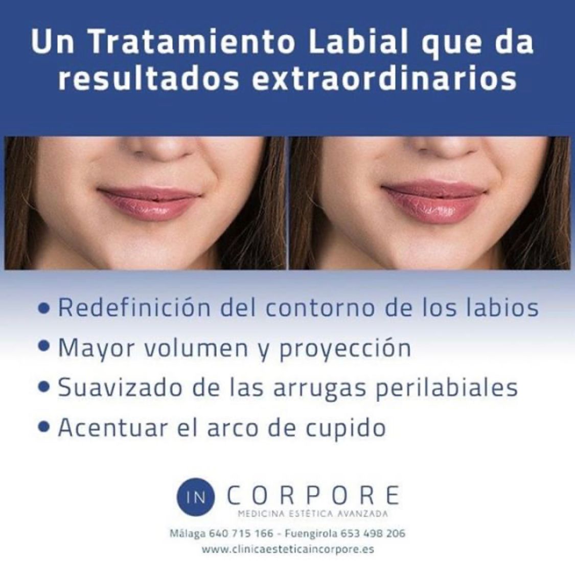 Juan Enrique Pérez Enríquez-32