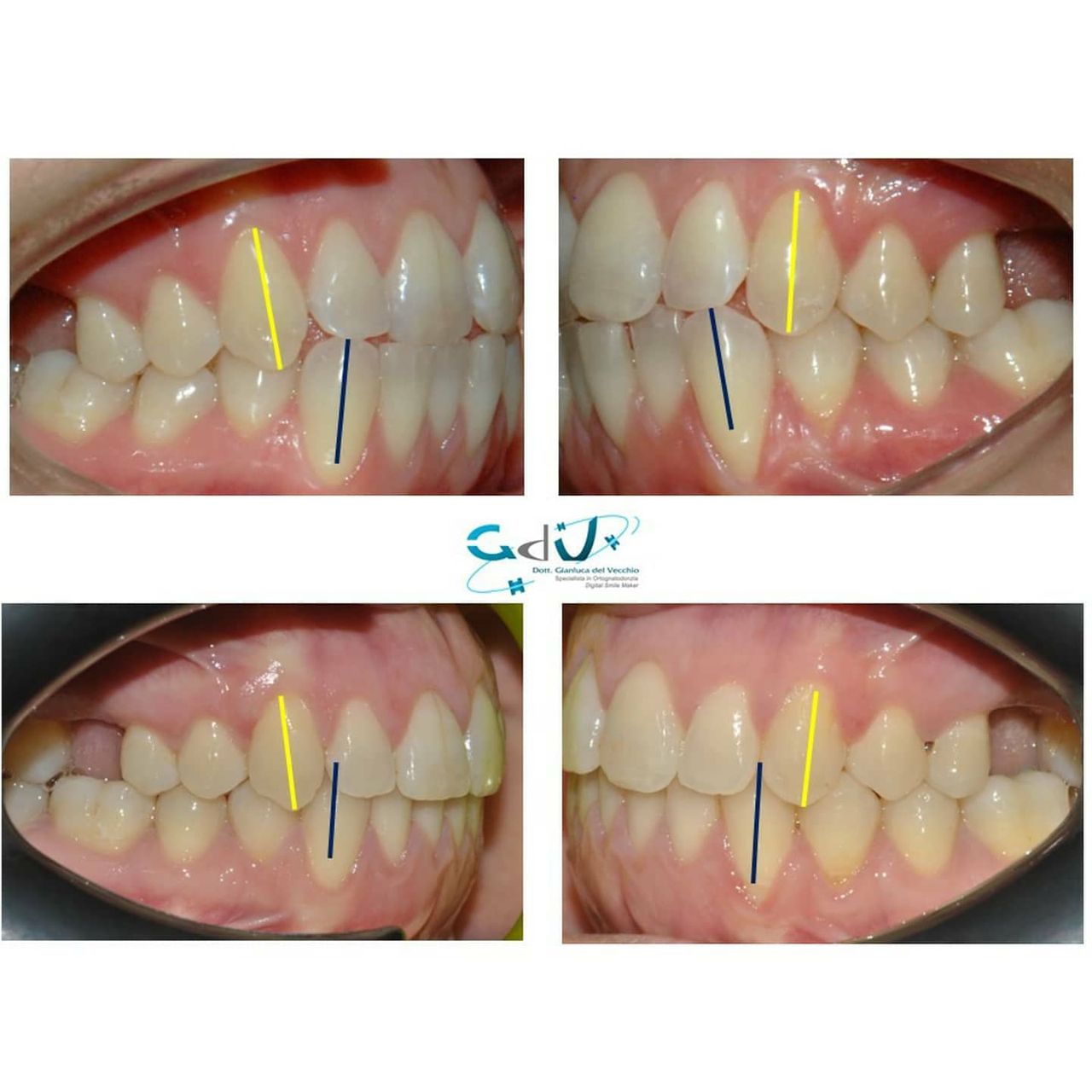 Gianluca Del Vecchio-111