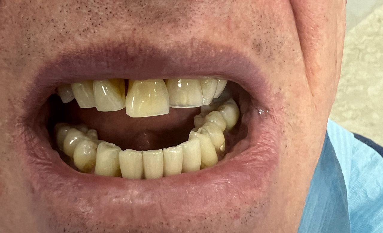 Luigi Aiardo Esposito-15