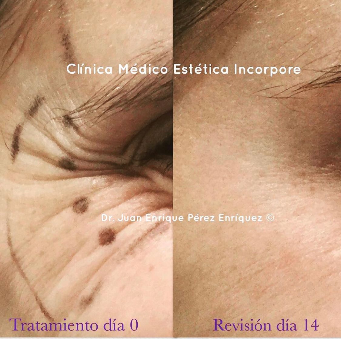 Juan Enrique Pérez Enríquez-106